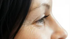 Warum entstehen Falten im Augenbereich? Fünf Faktoren, auf die kaum jemand achtet